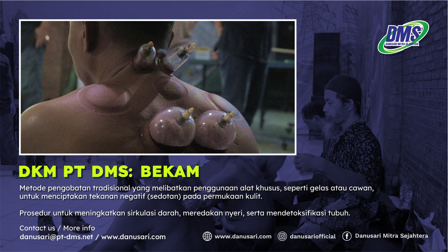 PT DMS Holds Free Cupping Program for Employees